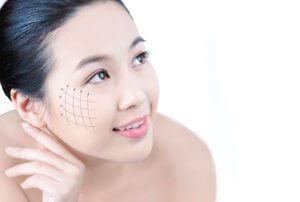 Secrets of Skin Rejuvenation Without Surgery List