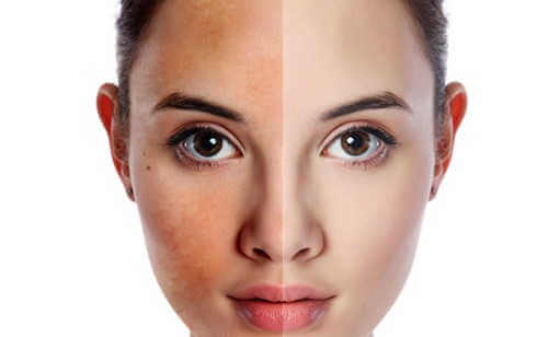 Causes of uneven skin tone