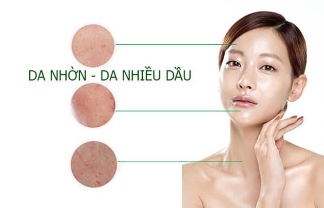 lý do da nhờn dễ bị thâm mụn