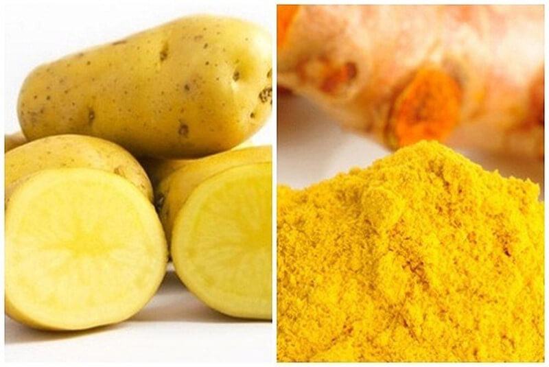 Treat acne with potatoes and turmeric