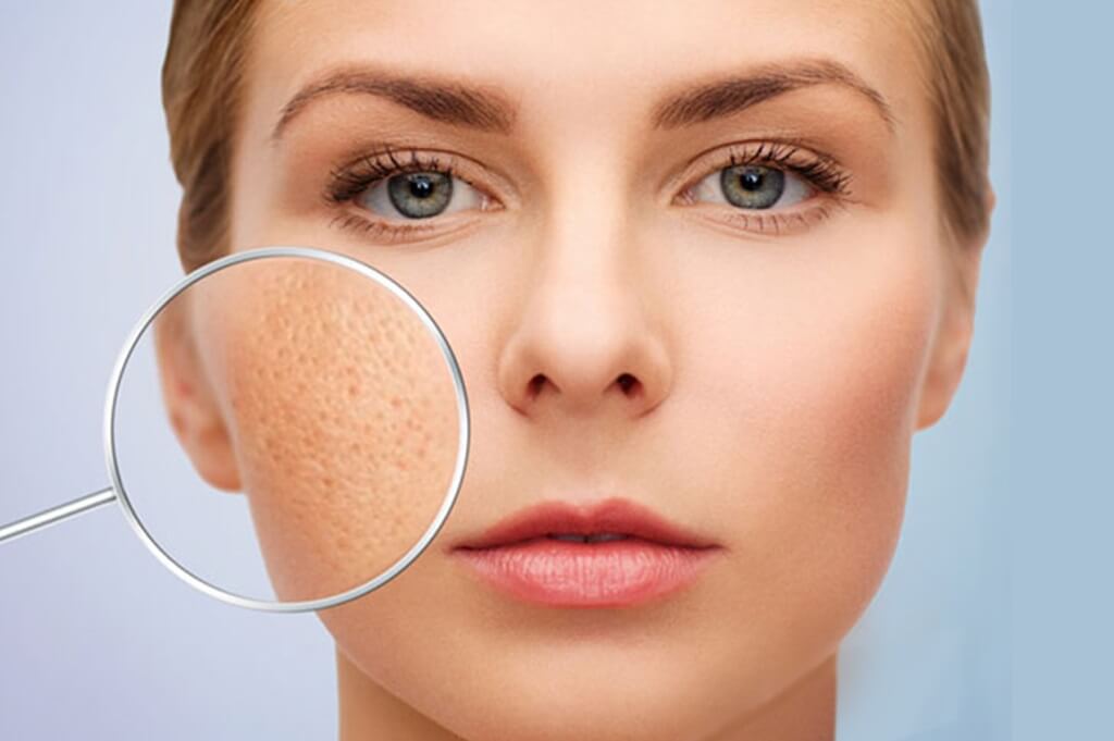 Causes of oily skin with large pores