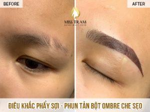 Điêu Khắc Phẩy Sợi - Phun Tản Bột Kết Hợp Ombre Che Sẹo Chân Mày Người trong cuộc