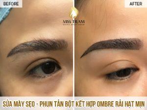 Khắc Phục Cho Chân Mày Bị Sẹo - Phun Tản Bột Kết Hợp Ombre Rải Hạt Mịn Người trong cuộc