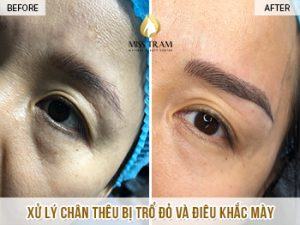 Xử Lý Chân Mày Thêu Trổ Đỏ Và Điêu Khắc Mày Nữ Hoàng Cho Chị Anh Tin tức