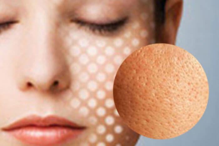 Pore ​​tightening formula for combination skin