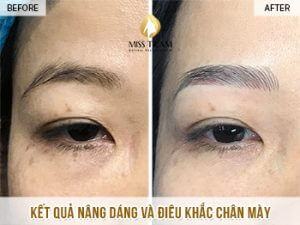 Nâng Dáng Và Điêu Khắc Chân Mày Cho Chị Tuyết Tin tức