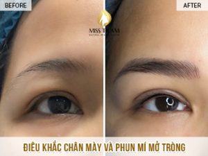 Điêu Khắc Chân Mày Và Phun Mí Mở Tròng Cho Chị Trinh Tin tức