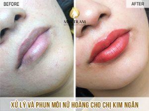 Xử Lý Và Phun Môi Nữ Hoàng Cho Chị Kim Ngân Nắm bắt