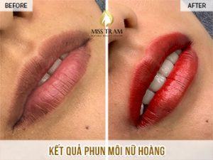 Kết Quả Phun Môi Nữ Hoàng Cho Chị Trang Tin tức