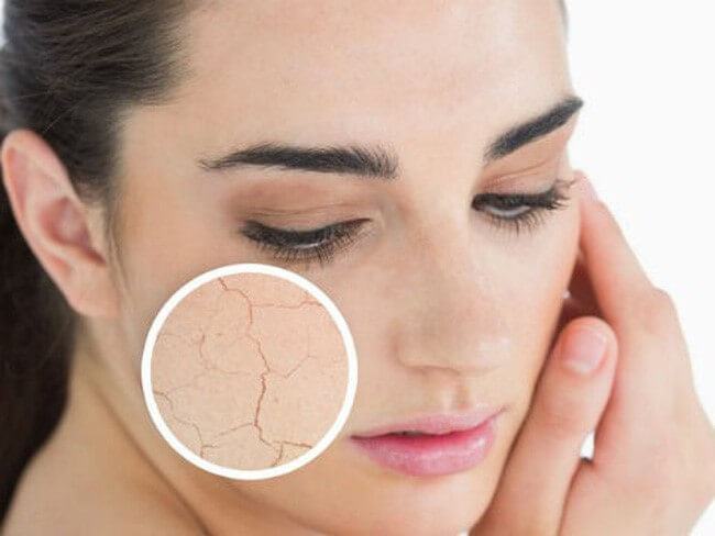 The Secret To Care For Dry White Smooth Skin Open Your Eyes
