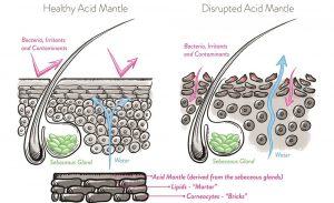 A Serious Mistake That Makes Mantle Acid Membrane Protect The Skin Completely Affected