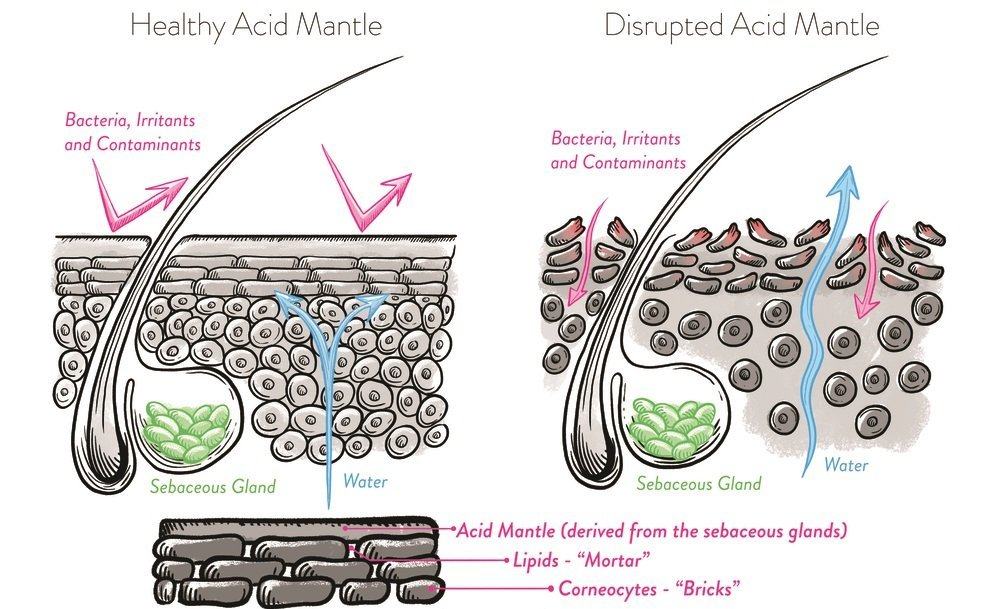 Serious Mistakes Cause the Mantle Acid Membrane to Protect Affected Skin News