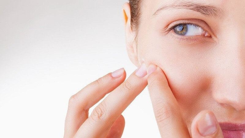The culprit causing hidden acne and effective treatment Reviews