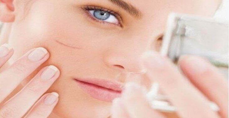 Thực Phẩm Làm Chậm Quá Trình Liền Sẹo