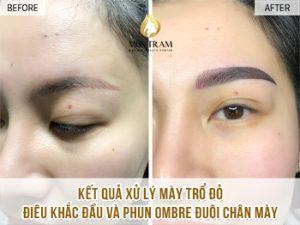 Khắc Phục Mày Cũ - Điêu Khắc Và Phun Ombre Chân Mày Của Chị Trâm Mở mắt