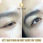 Phun Mí Mắt Nước "Ấn Tượng" Cho Chị Vy Nghiên cứu