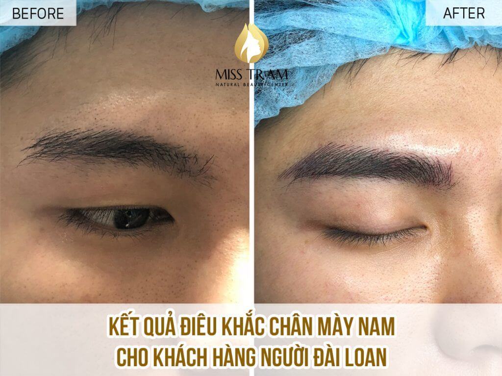 Kết Qủa Khách Hàng Nam - Người Đài Loan Điêu Khắc Chân Mày Suy nghiệm