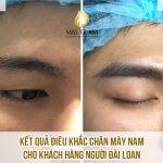 Kết Qủa Khách Hàng Nam - Người Đài Loan Điêu Khắc Chân Mày Nghiên cứu