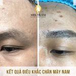 Anh Tài Lựa Chọn Làm Đẹp Chân Mày Bằng Công Nghê Điêu Khắc Nghiên cứu