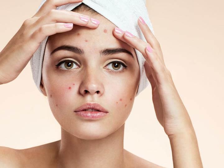 facial skin care process after squeezing acne