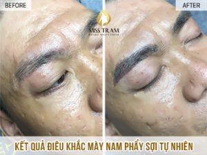 Kết Quả Thực Hiện Điêu Khắc Mày Nam Cho Anh Hiếu Nắm bắt