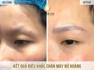 Hoàn Thành Quy Trình Điêu Khắc Mày Nữ Hoàng Cho Chị An Mở mắt