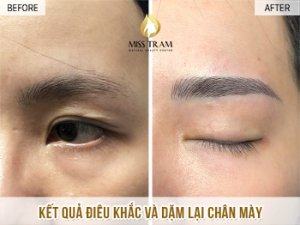 Kết Quả Điêu Khắc Và Dặm Lại Chân Mày Cho Chị Ánh Tin tức