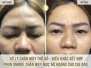 Xử Lý Mày Trổ Đỏ - Điêu Khắc Và Phun Ombre Đôi Mày Mới Cho Chị Đào Mở mắt