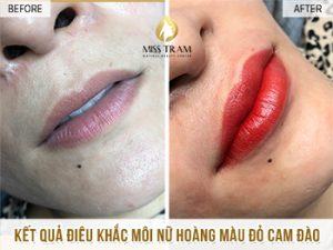 Kết Quả Điêu Khắc Môi Nữ Hoàng Màu Đỏ Cam Cho Chị Thảo Mở mắt