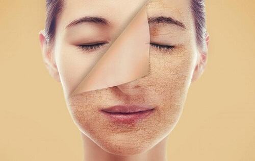 How To Restore Injured Facial Skin Effectively At Home Possibility