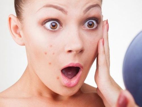mistakes when treating acne at home