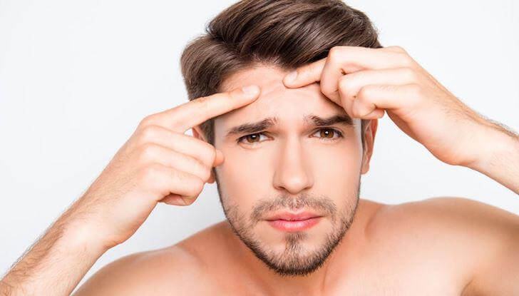 The cause of acne treatment does not go away in men