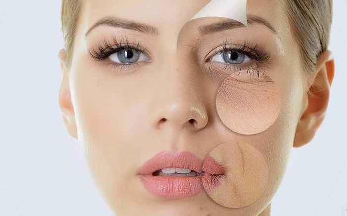 Tracing the Causes of Total Sagging Facial Skin