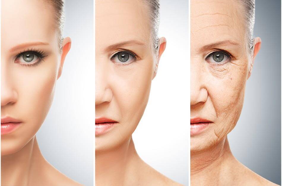 Aging causes sagging facial skin