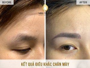 Chị Trúc Giang Làm Đẹp Chân Mày Bằng Công Nghệ Điêu Khắc Mở mắt