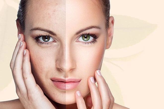 Grasping the Cause To Treat Aging Skin Effectively