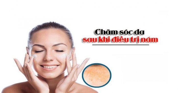 Chăm Sóc Da Như Thế Nào Sau Khi Điều Trị Nám