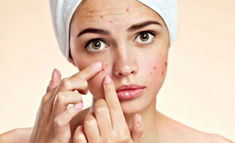 Should acne skin use a mask?