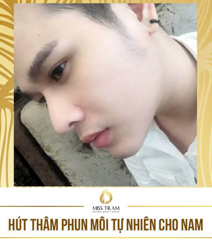 Kết quả phun môi cho nam giới đẹp