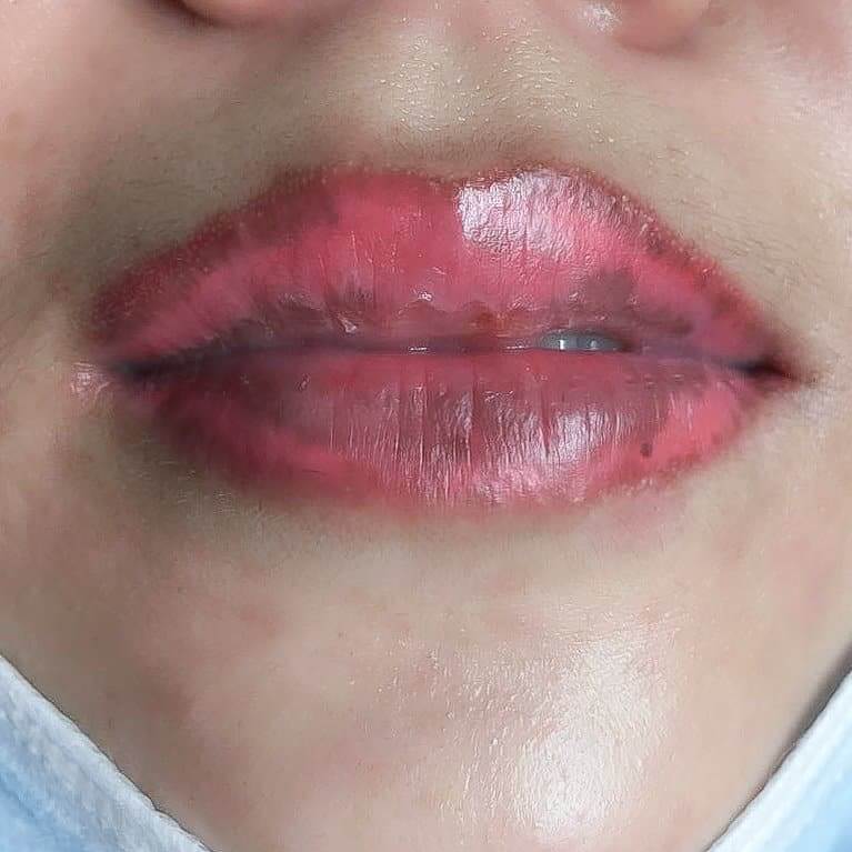 How to handle when lip spray fails