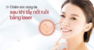 Skin Care Experience After Laser Mole Removal Understanding