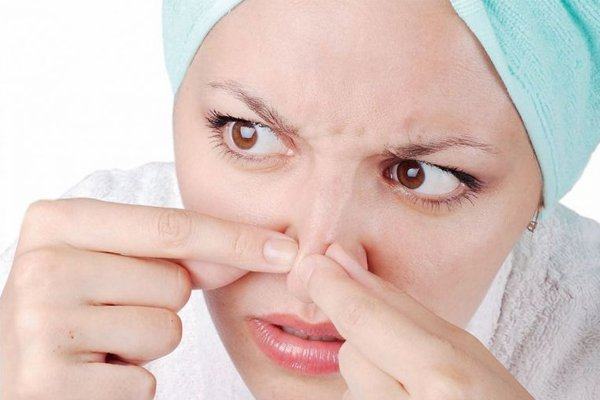 Want To Get Rid Of Acne Should You Squeeze Acne? Security