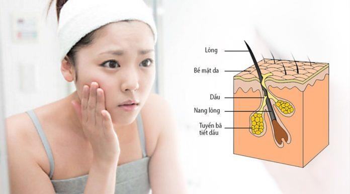 What causes skin pores to become larger?