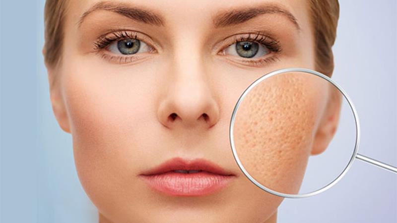 What causes skin pores to become larger?
