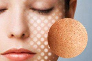 Causes of Larger Pores on Skin Few people know