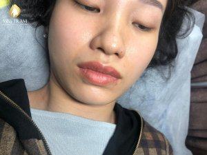 Xử Lý Môi Thâm Chì - Phun Môi Pha Lê Collagen Màu Hồng Cam Tự Nhiên Cho Chị Tuyền Tin tức