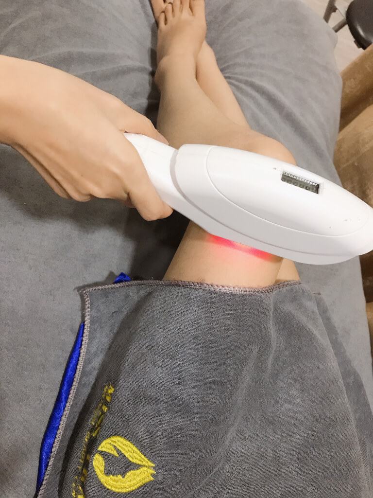 Phương pháp triệt lông bằng Laser hiệu quả