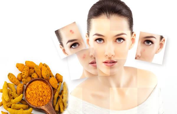15 Effective Ways To Treat Acne At Home From Natural Materials Ideas
