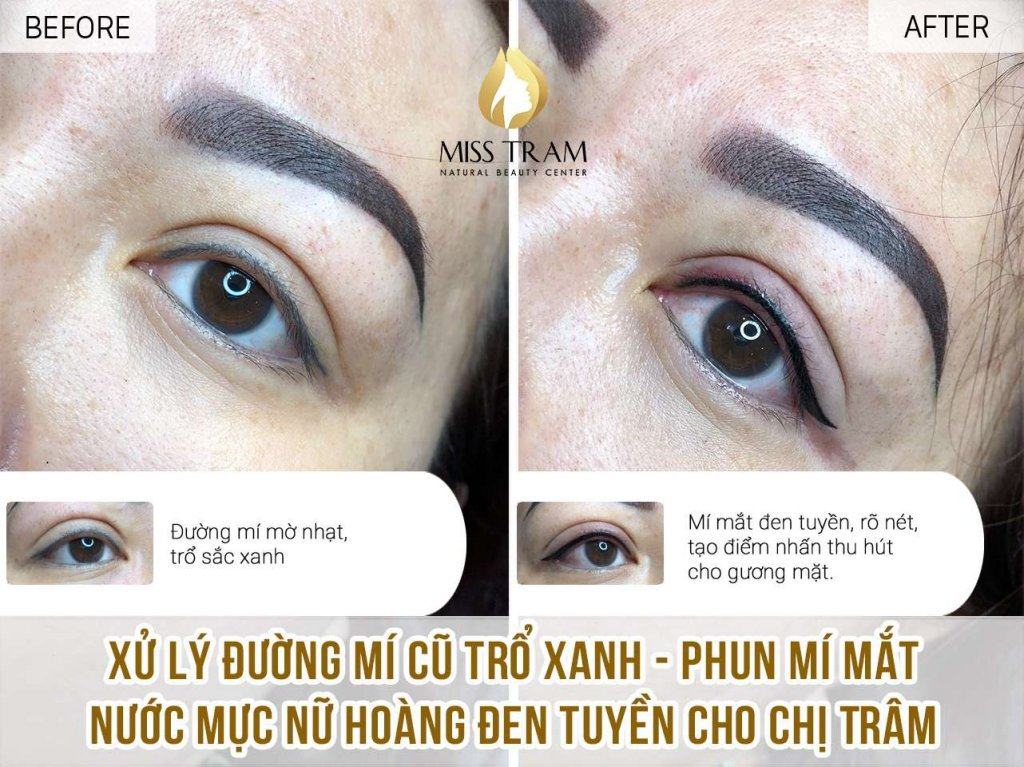 Treating Old Eyelids With Green - Spraying Black Queen Ink Watery Eyelids For Ms. Tram