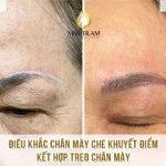 Điêu Khắc Chân Mày Che Khuyết Điểm Treo Chân Mày Cho Cô Phượng Nghiên cứu